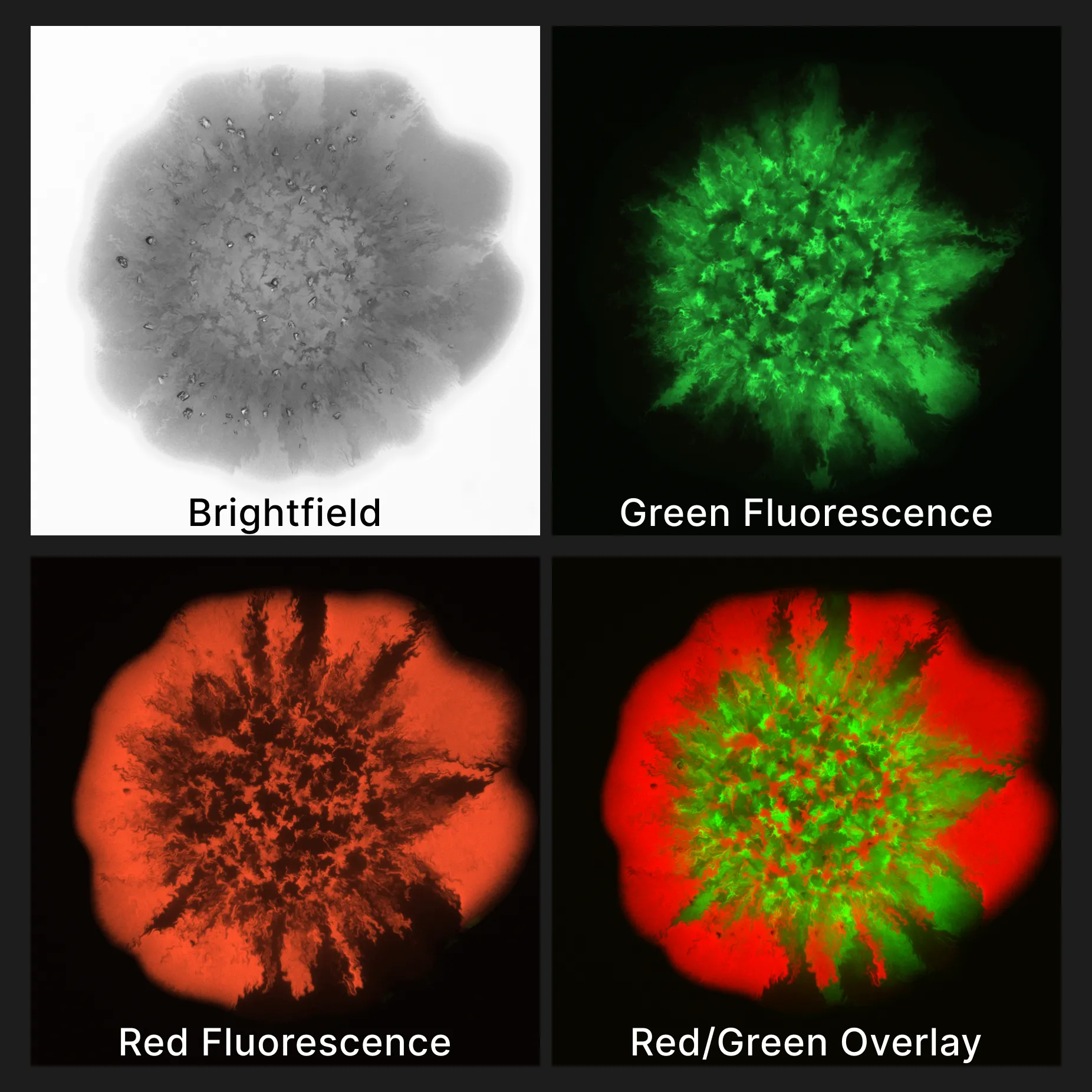 Bacterial Fluorescence meets the Kestrel™: How Image Processing is